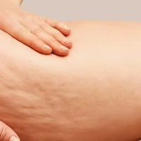 Cellulite Amoseeds, specialista dei super-alimenti bio (1)